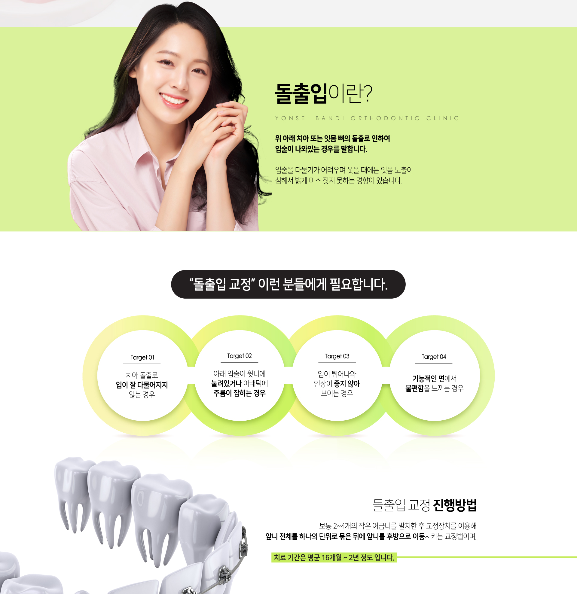 돌출입이란? 위 아래 치아 또는 잇몸 뼈의 돌출로 인하여 입술이 나와있는 경우를 말합니다. 보통 2~4개의 작은 어금니를 발치한 후 교정장치를 이용해 앞니 전체를 하나의 단위로 묶은 뒤에 앞니를 후방으로 이동시키는 교정법이며 치료기간은 평균 16개월~2년정도입니다.