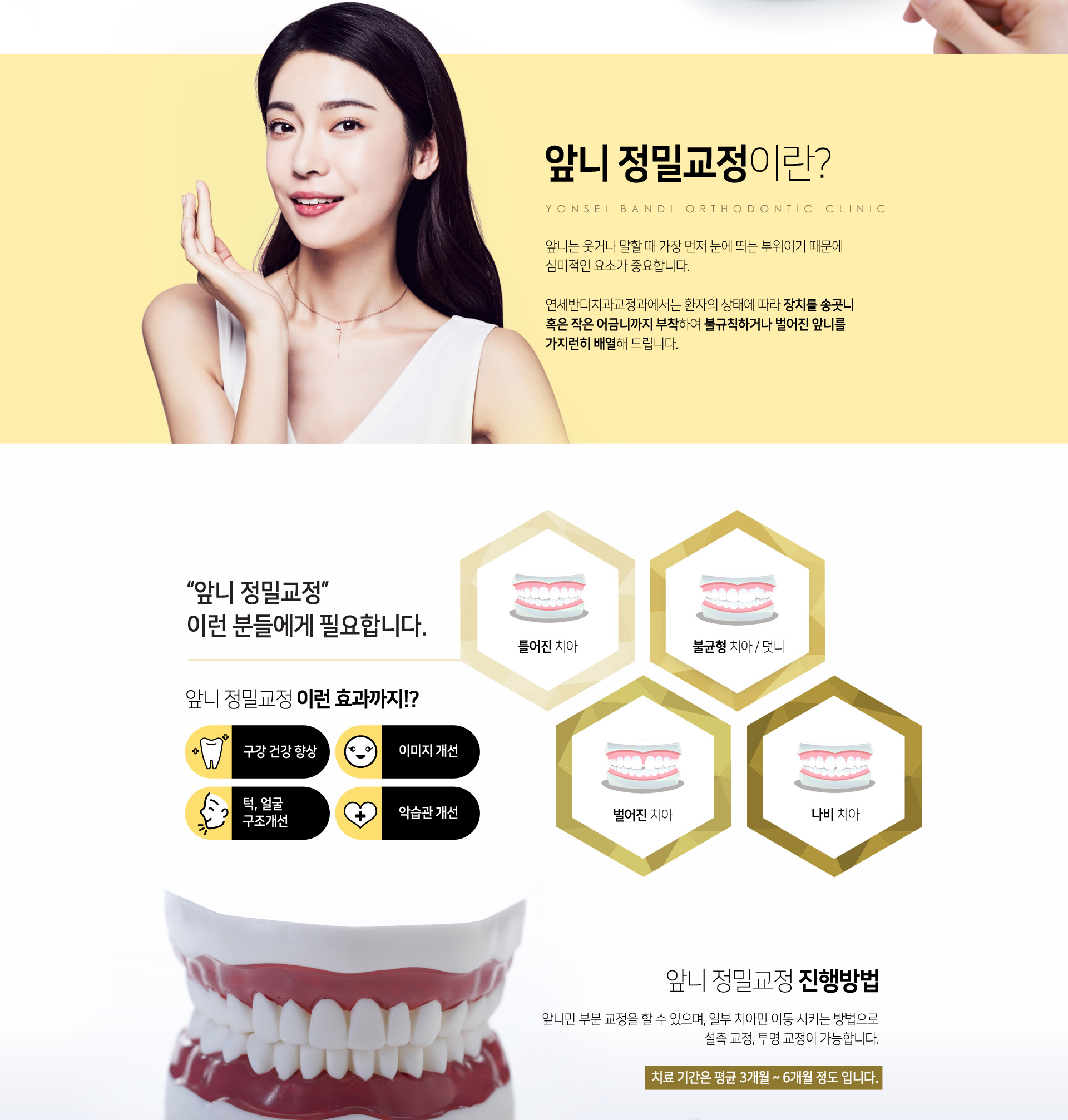 앞니 정밀교정이란? 앞니는 웃거나 말할때 가장 먼저 눈에 띄는 부위이기 때문에 심미적인 요소가 중요합니다. 앞니만 부분교정을 할 수 있으며 일부 치아만 이동시키는 방법으로 설측교정, 투명교정이 가능합니다. 치료기간은 평균 3개월~6개월정도입니다.